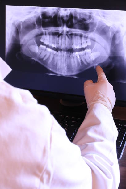 Best Emergency Dental Care for Abscessed Tooth in Kingsford, MI