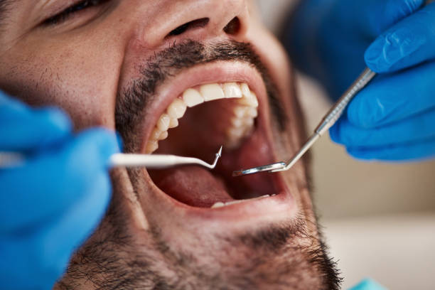 Best Mobile Emergency Dentist in Kingsford, MI