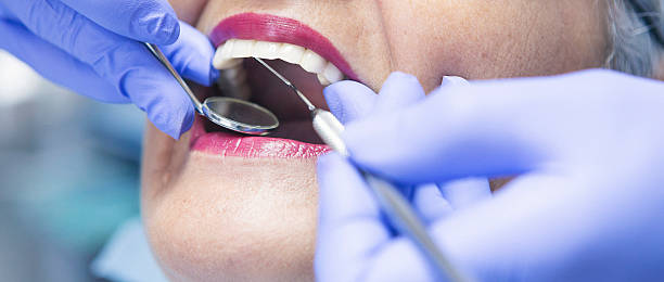 Best Emergency Dental Extractions in Kingsford, MI